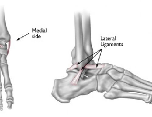 Understanding Ankle Sprains – The how, what and where